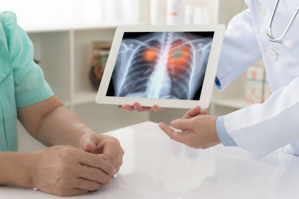 Best Lung Cancer Treatment Doctor in Marine Lines